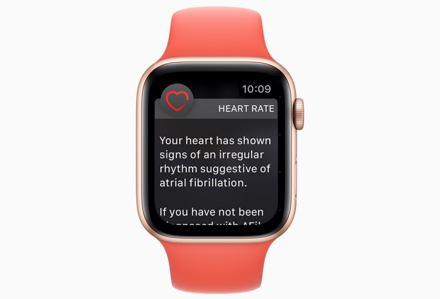 Apple Watch s upozorněním AFib na srdeční frekvenci