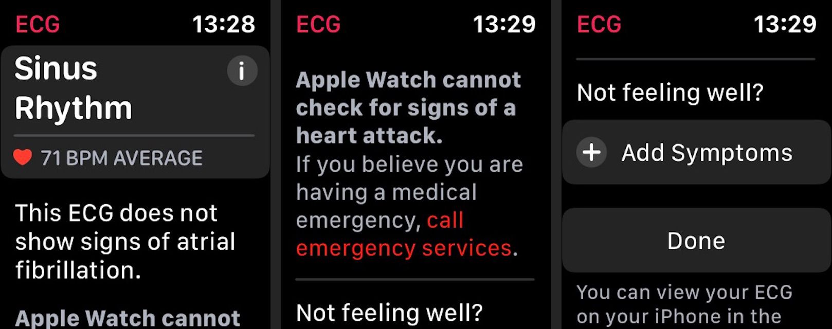 Výsledky EKG Apple Watch