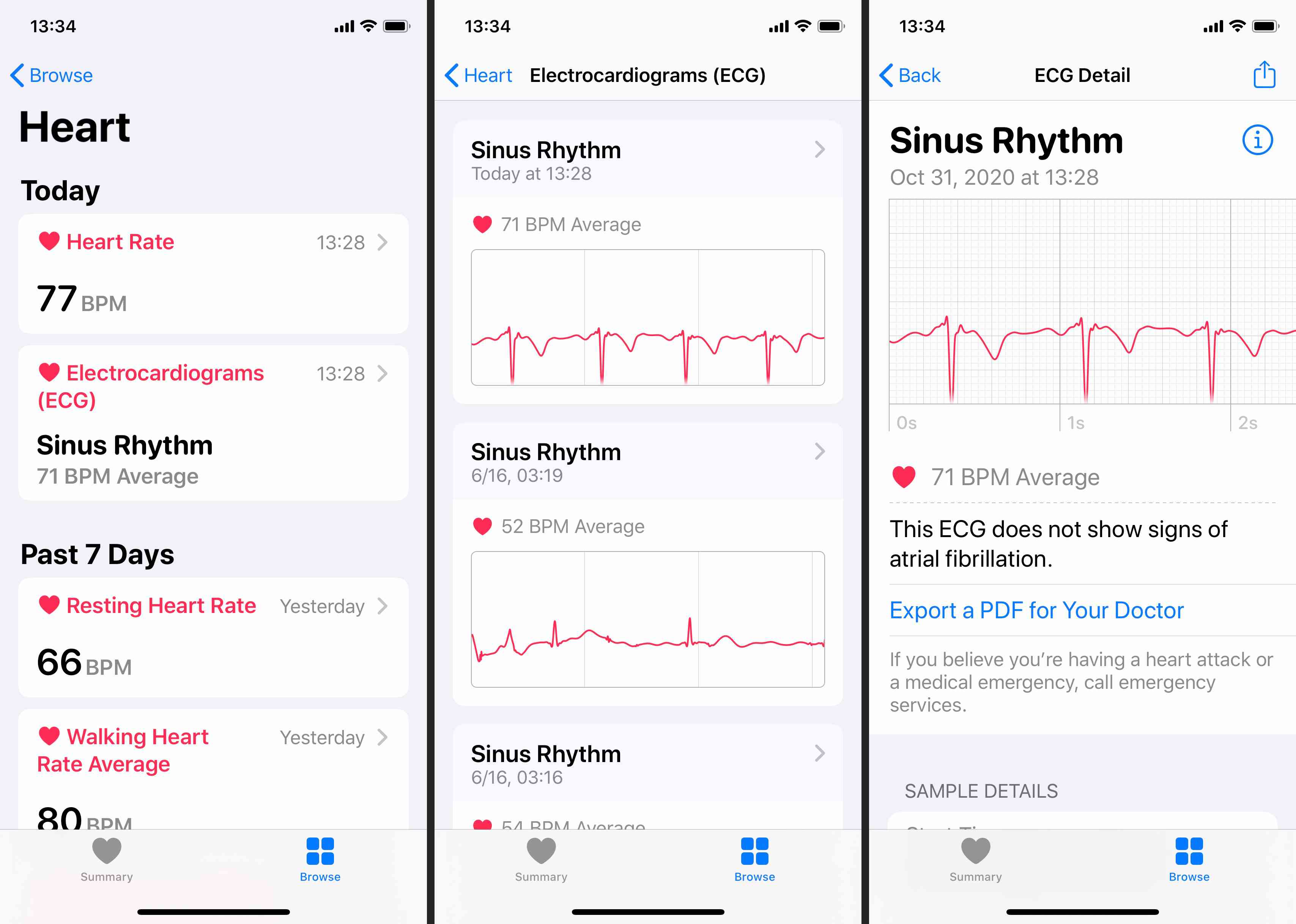Výsledky EKG si také můžete prohlédnout v aplikaci Zdraví na spárovaném iPhonu.
